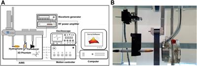 Factors Associated with Energy Efficiency of Focused Ultrasound Through the Skull: A Study of 3D-Printed Skull Phantoms and Its Comparison with Clinical Experiences